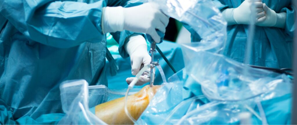 Huidige afbeelding: Onnodige operaties