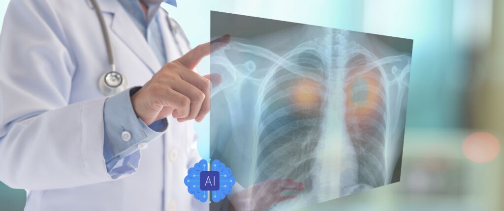 AI signaleert longkanker 4 maanden sneller dan de huisarts