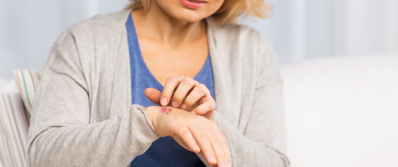 Scabiës-golf in huisartsenpraktijken: schurft terug op niveau