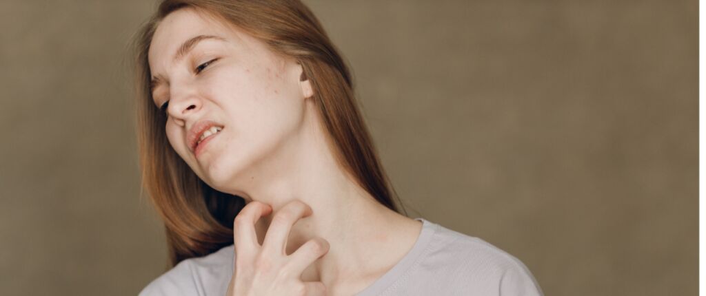 Huidige afbeelding: Schurft