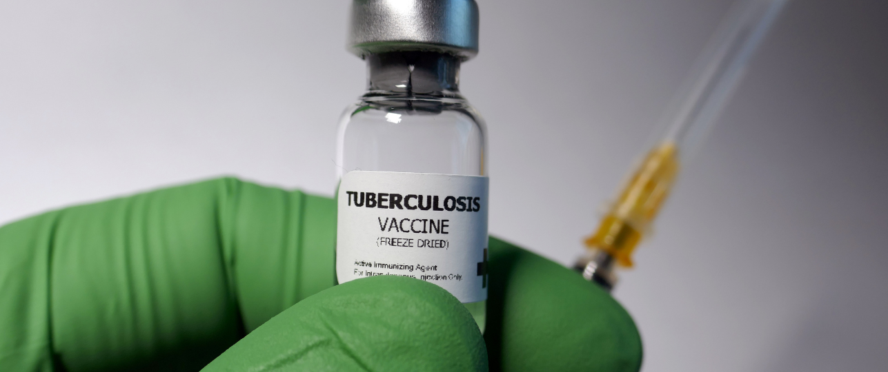 Bestrijden Tuberculose (tbc) reden tot paniek?