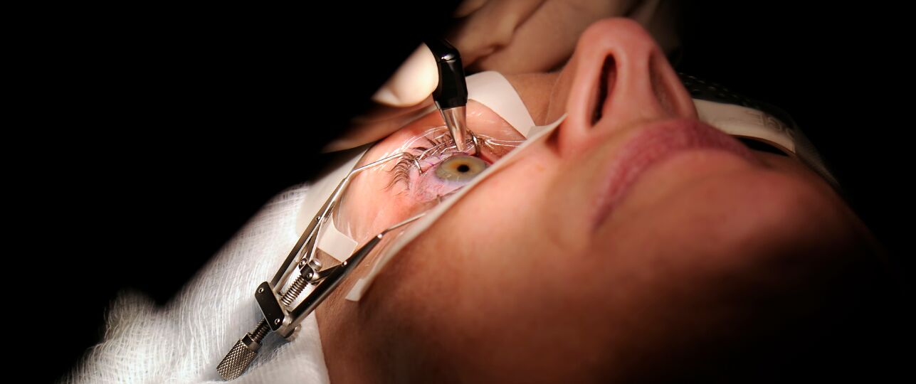 Nieuwste EMR-behandeling, zonder laseren, veelbelovend