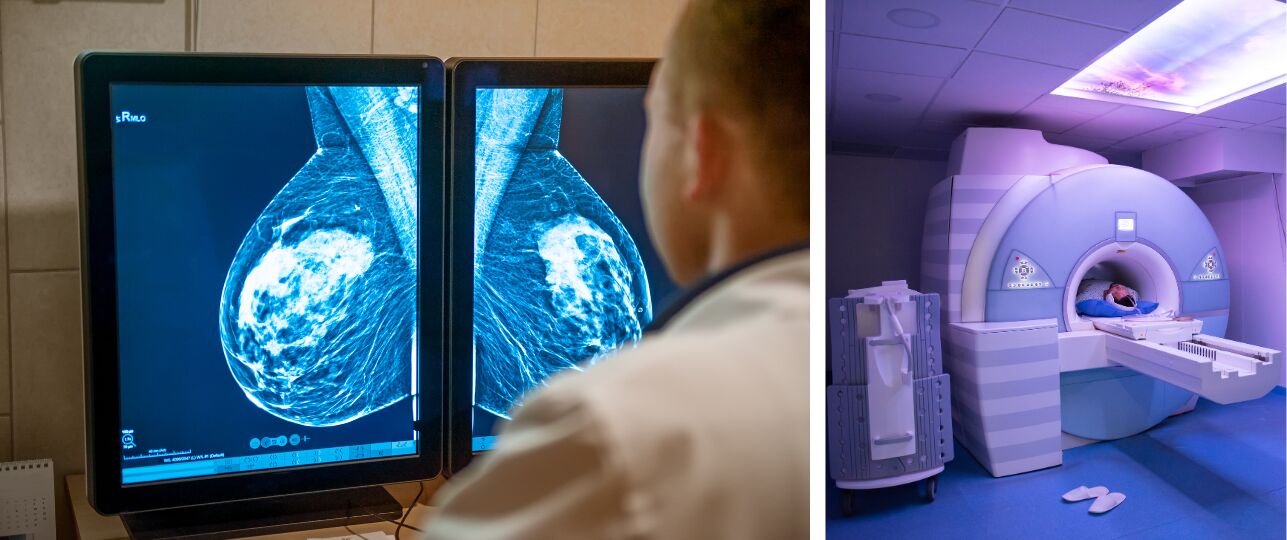 dicht borstweefsel korstkankeronderzoek