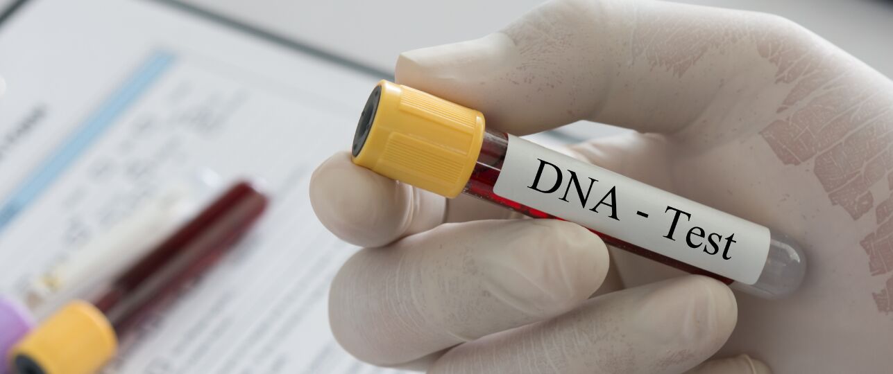 DNA test