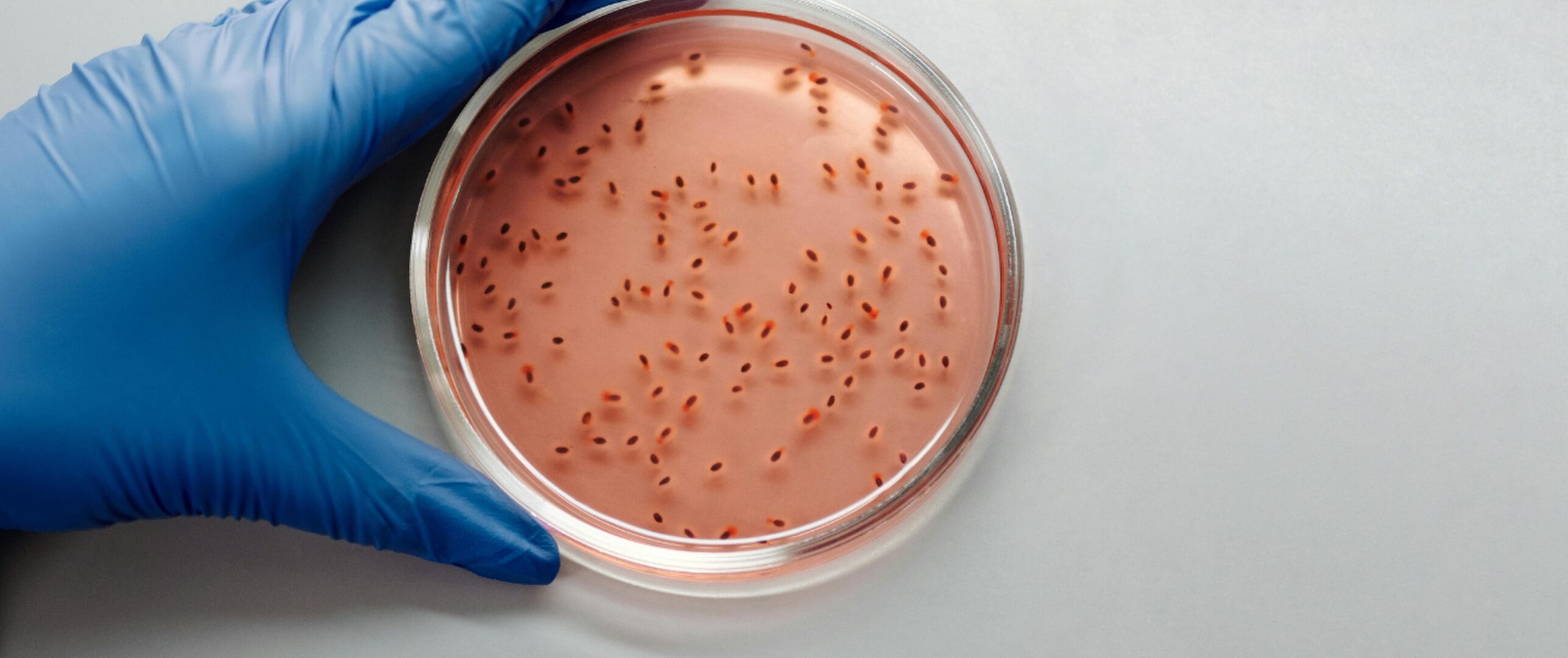 Poepbacteriën en E. coli