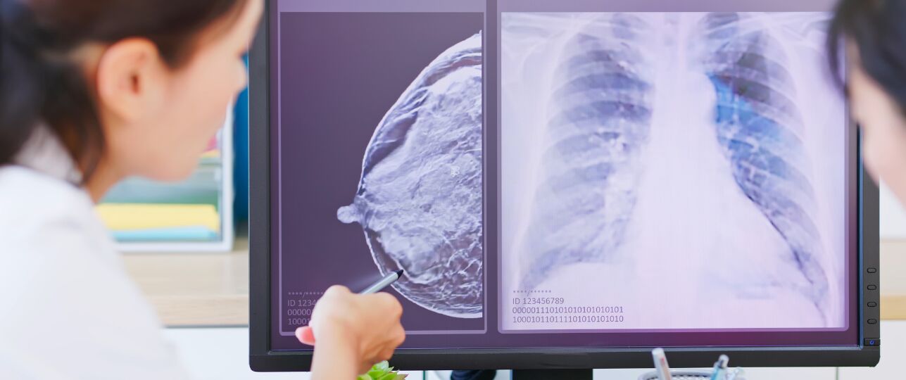 borstkankeronderzoek