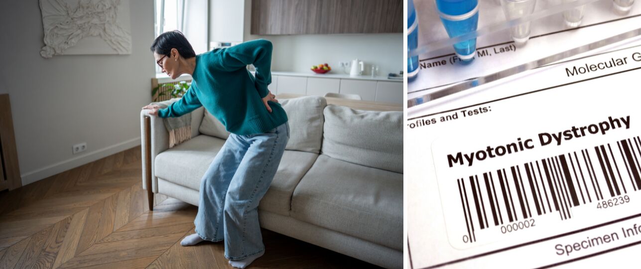 myotone dystrofie