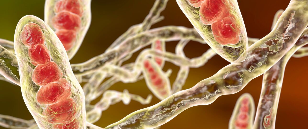 schimmelinfecties zoals ringworm