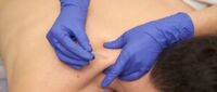 Wat is dry needling? Alles wat je moet weten over deze spierbehandeling