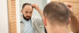 kaal worden, beginnende kaalheid
