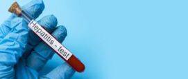 Hepatitis