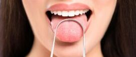 Wat zegt je tong over je gezondheid?