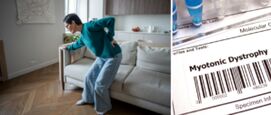 myotone dystrofie