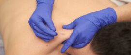 Wat is dry needling? Alles wat je moet weten over deze spierbehandeling