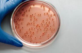 Poepbacteriën en E. coli