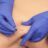 Wat is dry needling? Alles wat je moet weten over deze spierbehandeling
