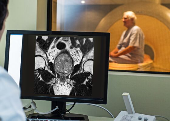 Prostaatkanker neemt toe: belang van vroege opsporing groeit