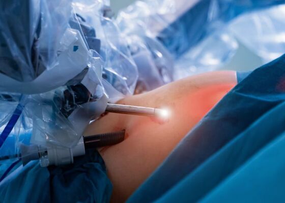 Innovatie in microchirurgie
