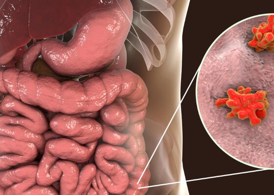 Parasieten bij mensen