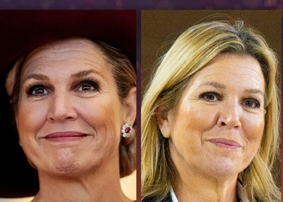 botoxgezicht koningin Máxima