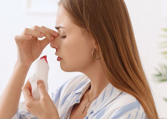 Wanneer moet je met een bloedneus naar de huisarts?