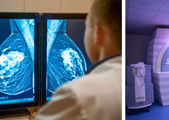 dicht borstweefsel korstkankeronderzoek