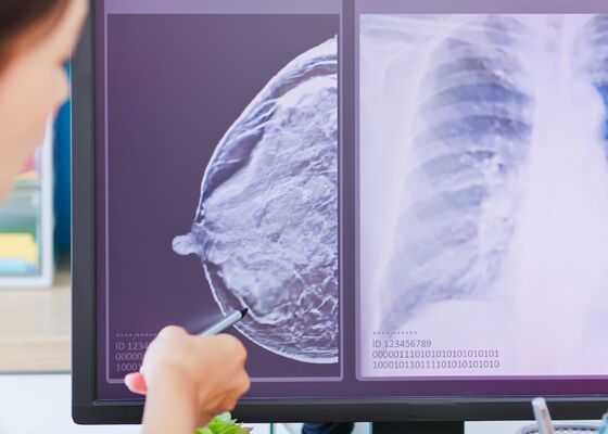 borstkankeronderzoek