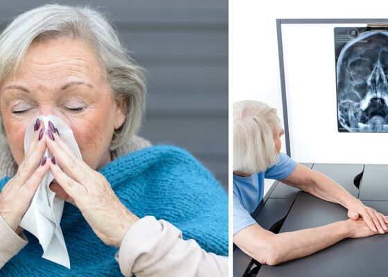 chronische sinusitis