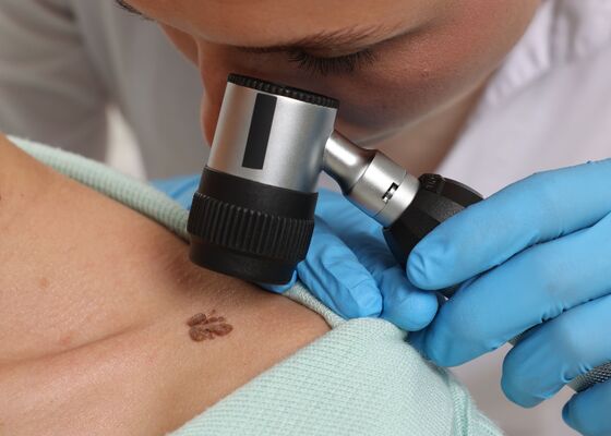 gevaarlijke vlekken controleren